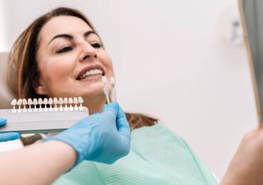 Best Dental Implants in Bangalore