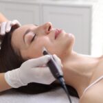 skin needling