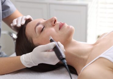 skin needling