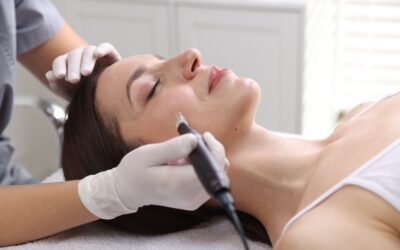skin needling