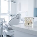 Full Mouth Implants