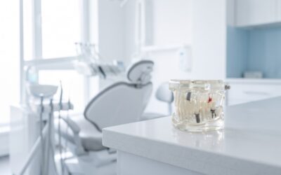 Full Mouth Implants