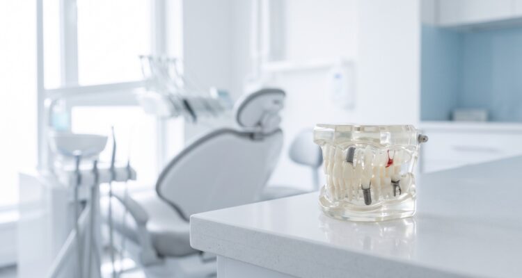 Full Mouth Implants