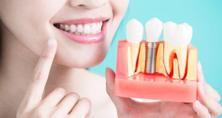 Root canal treatment price