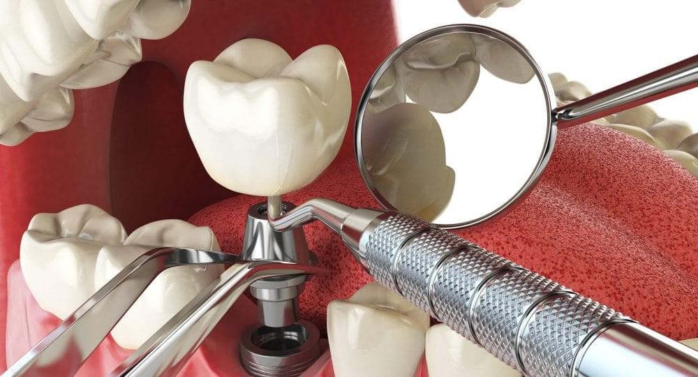 prosthodontics
