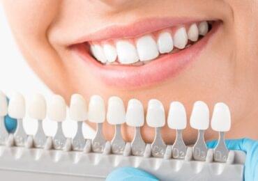 Best Cosmetic Dentistry in Bangalore
