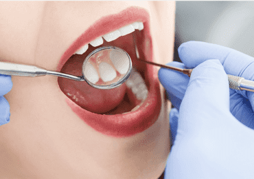 Dental Checkup in Richmond Road