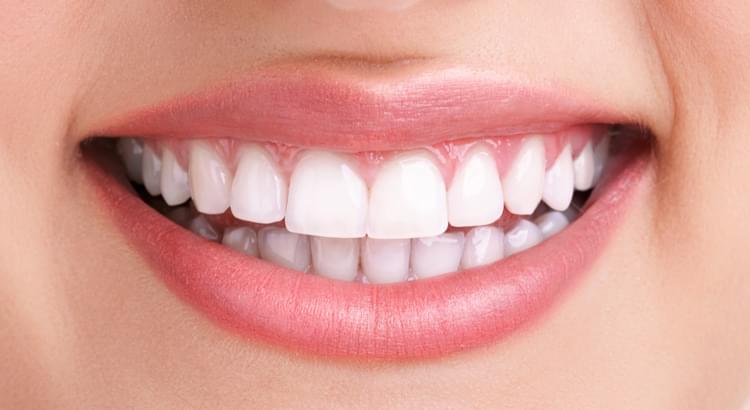 Best Teeth Whitening