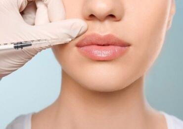  Dermal Fillers in Bangalore