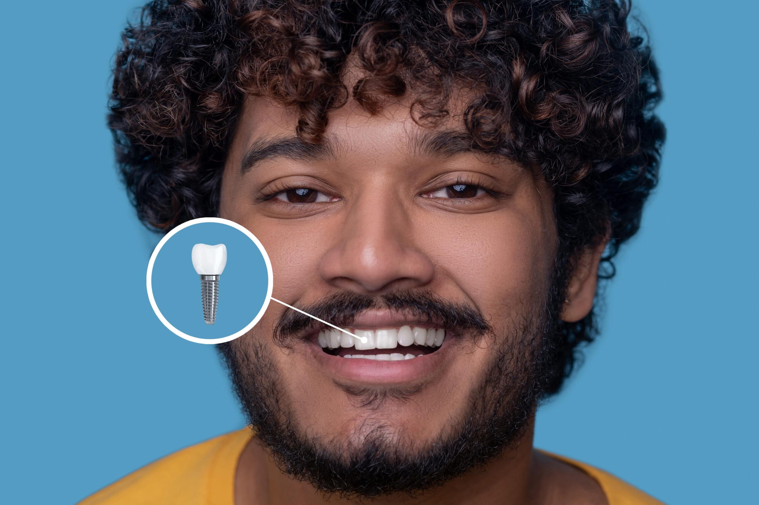 Root canal