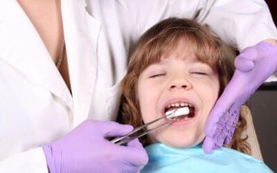 root canal treatment