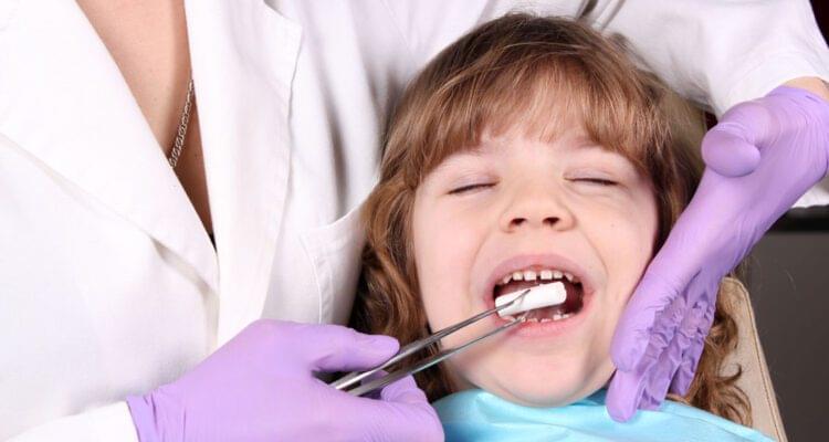 root canal treatment